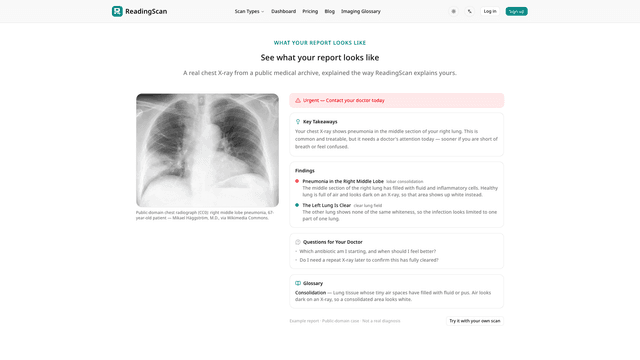 ReadingScan screenshot 2
